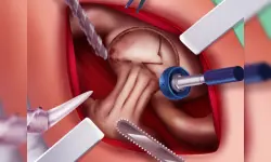 Princess Hips Surgery image