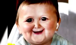 Funny Hasbulla Face image